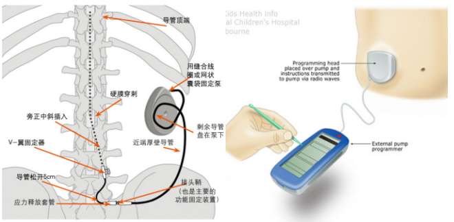 微信图片_20250617133510.png